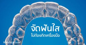จัดฟันแบบใส